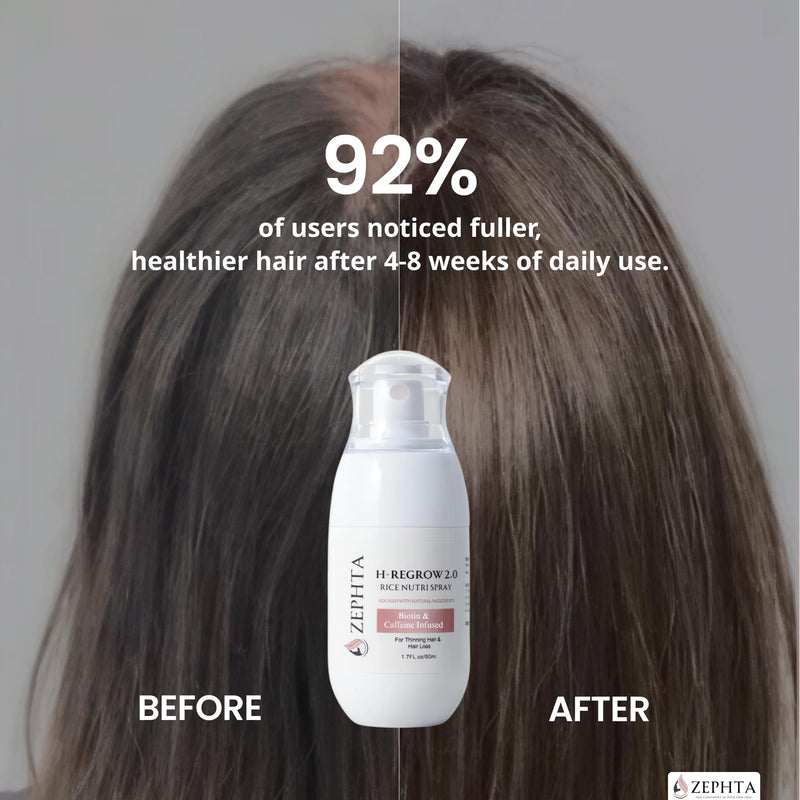 H-Regrow Hair Growth Spray – With Rice Water, Biotin, Aloe Vera, Caffeine, and Ginger – Hair Growth Product for Men and Women – For Thinning Scalp