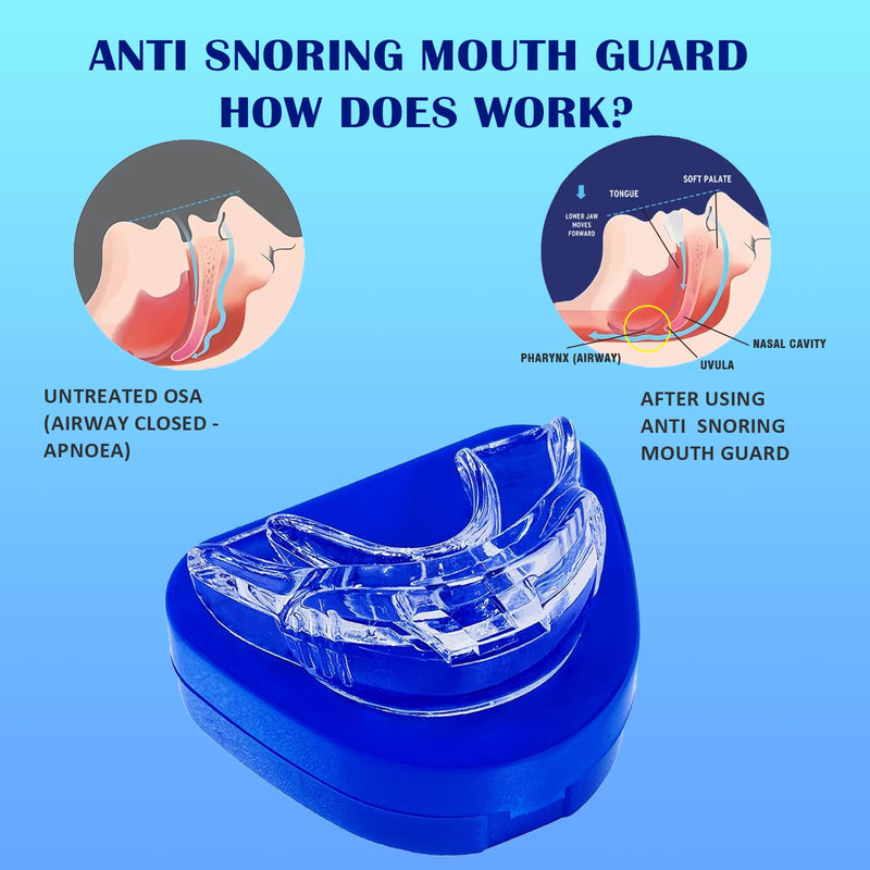 [Australia] - Anti-Snoring Mouthpiece, Snoring Solution for Men and Women (OTC use) -L006 White Large 