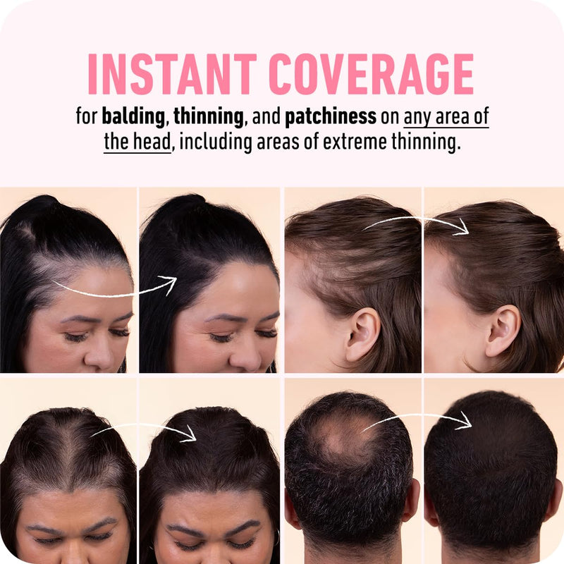Boldify Hairline Powder, Root Touch Up Hair Color Black 4g | Instantly Fills Thinning Hair & Sparse Hairlines - Root Cover Up for Gray Hair - Water-Resistant, Sweat-Proof 24-Hour Wear