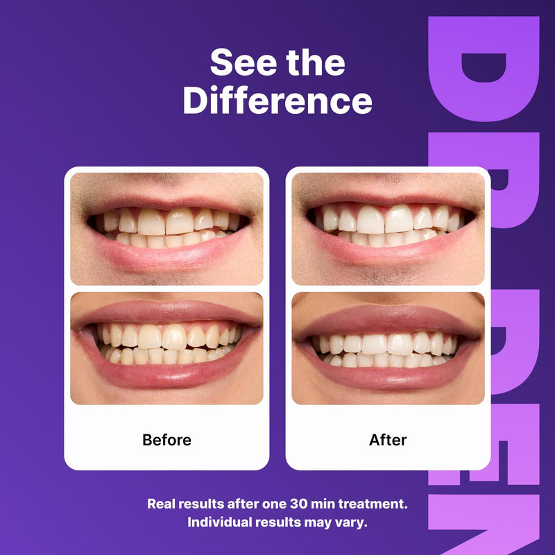 DRDENT Purple Teeth Whitening Strips 21 Treatments - Safe for Enamel - Non Sensitive Teeth Whitening - Whitening Without Any Harm - Pack of 42 Strips