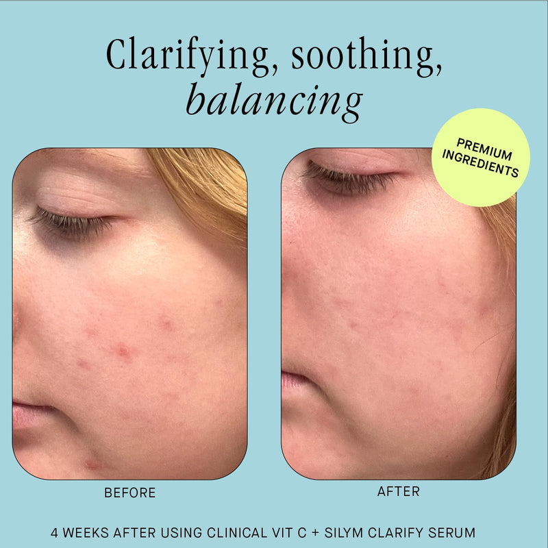 Brandefy Vitamin C + Silym Clarify Serum - Face Salicylic Acid Serum for Blemish-Prone Skin, Promotes Clear Complexion, Anti-Aging, Brightening, Made in the USA (1 oz)