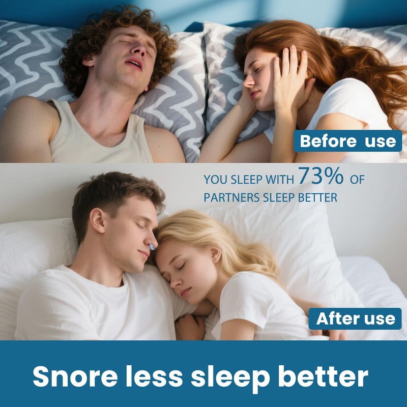 [Australia] - Nasal Dilators for SnoringÔºà2 Count), Extra Strength Nose Dilators for Breathing, Boost Oxygen Inhale, Improve Sleep Quality (1x Small & 1x Medium) Blue 