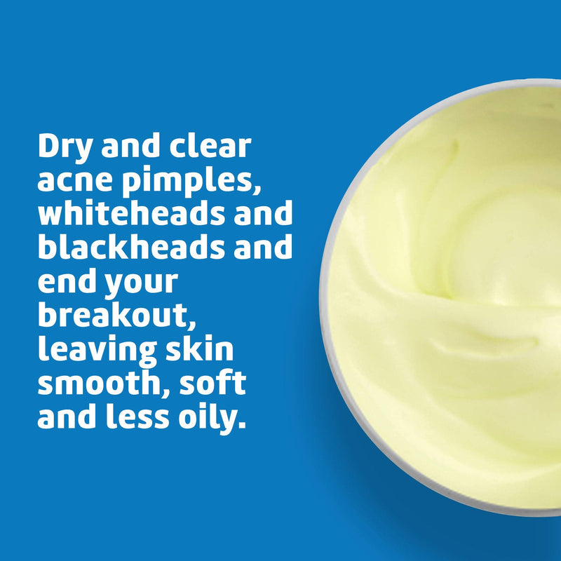[Australia] - De La Cruz 10% Sulfur Ointment - Cystic Acne Treatment for Face and Body - Daily 10 Min Spot Treatment Mask Safe and Effective Game Changing Hormonal Acne Treatment that Clears Up Pimples 0.21oz 6g 0.21 Ounce (Pack of 1) Maximum Strength 