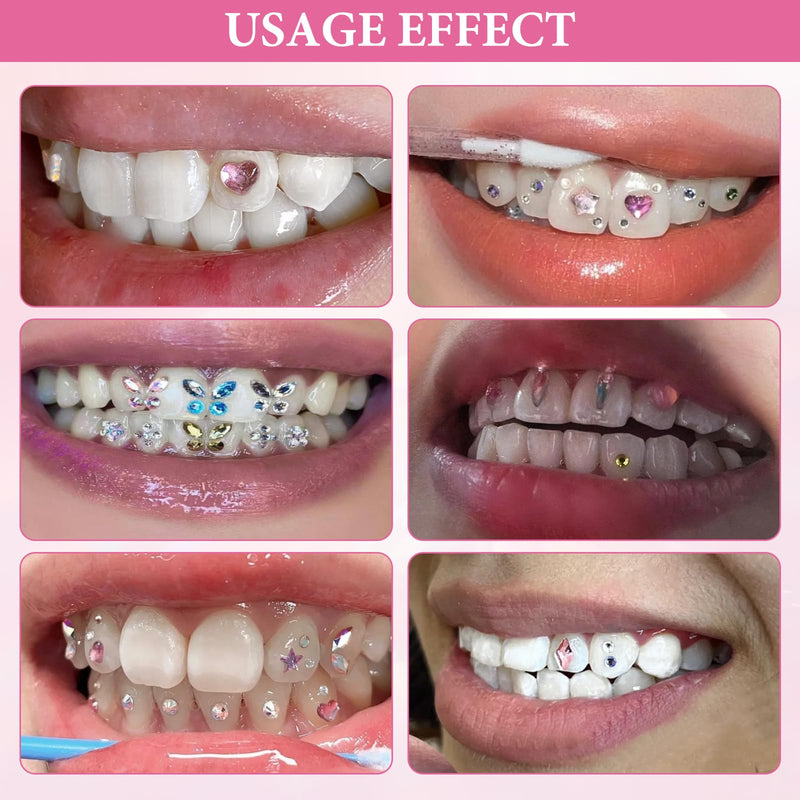 [Australia] - Tooth jewellery, tartar jewellery, tooth gem kit, tooth jewelery set, tartar set, DIY tooth gems with glue with 1485 pieces tooth gem decoration crystal gemstone rhinestone decoration 