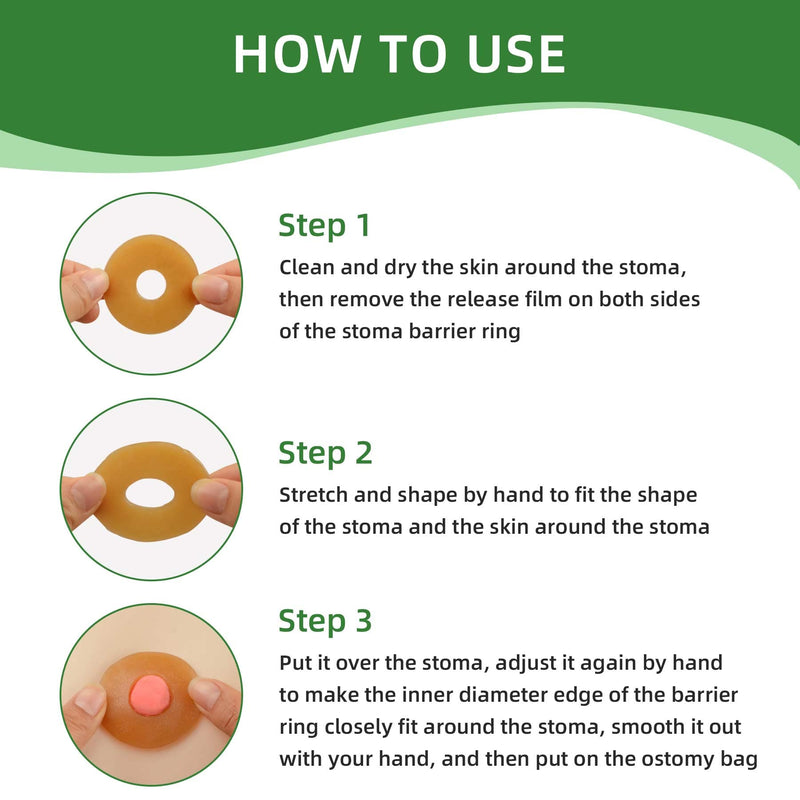 [Australia] - 10PCS Ostomy Barrier Rings, 2 / 4MM Moldable Ostomy Hydrocolloid Skin Extender Rings for Ostomy Bags (2mm-10pcs) 2mm-10pcs 