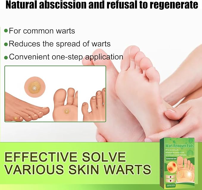WABRINY Wart Remover Pads, Maximum Strength One Step Bandages for Hands Neck Feet Fingers, 30 Treatments-RK 30 Count (Pack of 1)
