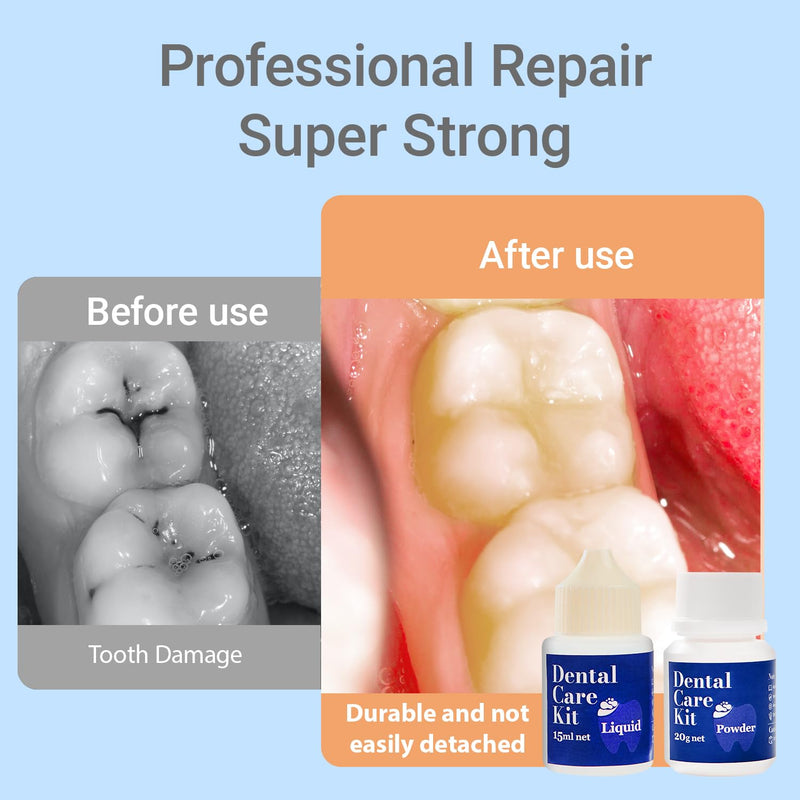 Tooth Repair Kit,Zinc Oxide Eugenol - Dental Cement,Cavity Filler for Teeth,for Crowns & Bridges Filling,Dental Glue,Provide Video tutorials 2pcs 8