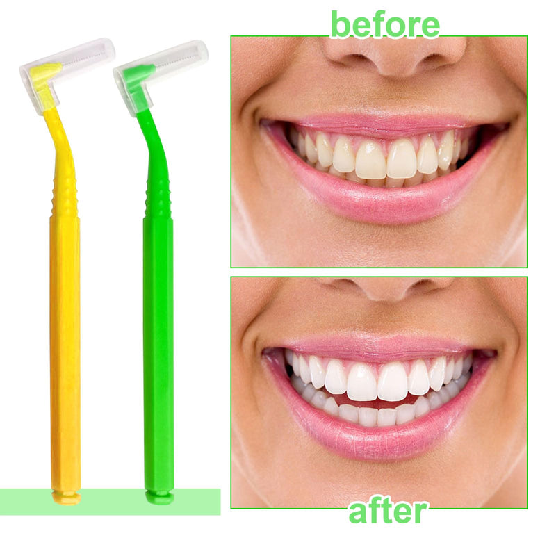 [Australia] - SKHAOVS Pack of 40 L-shaped interdental brushes with long handle, toothbrush between teeth and gums, tooth cleaning between spaces, for tooth cleaning plaque removal (yellow green) yellow green 