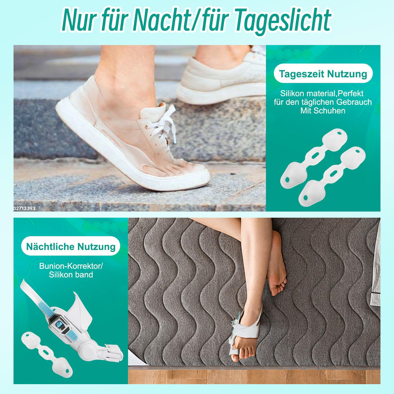 [Australia] - AESBELTA Hallux Valgus correction 