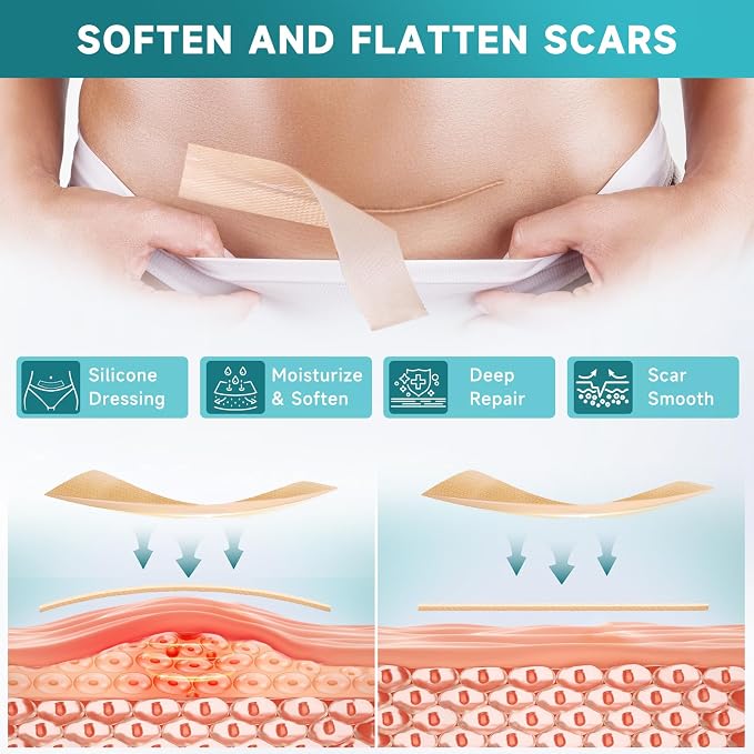 Medical-Grade Silicone Scar Tape Roll (1.6" x 118") Silicone Scar Sheets Keloid Bump Removal - Reusable Silicone Tape Scar Removal Strips, Scar Tape for Surgical Scars, C Section Scar Silicone Strips 1 Pack
