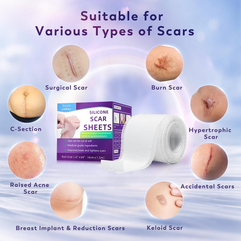 [Australia] - Silicone Scar Sheets, Silicone Scar Tape(1.6"x 60" Roll-1.5M), Medical Grade Scar Sheets, Scar Tape for Surgical Scars, Burn, C-Section, Keloid Scars, Acne Treatment, Stretch Marks Removal 1.5M 