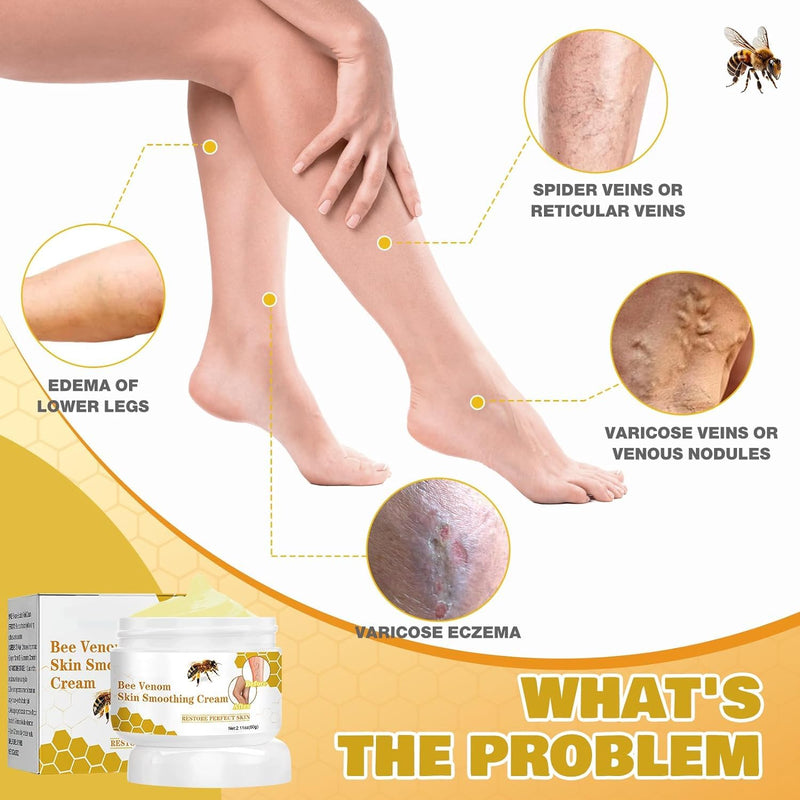 [Australia] - Pack of 2 bee venom varicose veins cream, Furzero varicose veins cream, varicose veins cream, bee venom pain cream, bee venom ointment, for everyone 