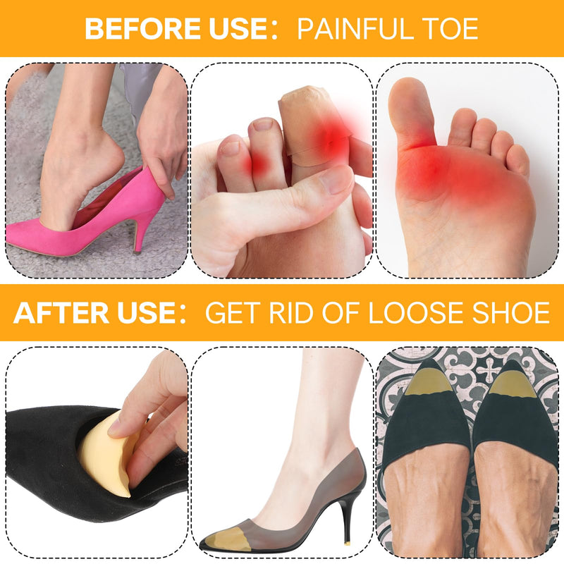 [Australia] - Gjinxi 3 pairs of toe filler inserts, adjustable toe filler, front shoe filler, toe cushion for shoes that are too large, shoe size reducer for women, men, high heels, suit shoes, casual flats (skin colour), skin colour 