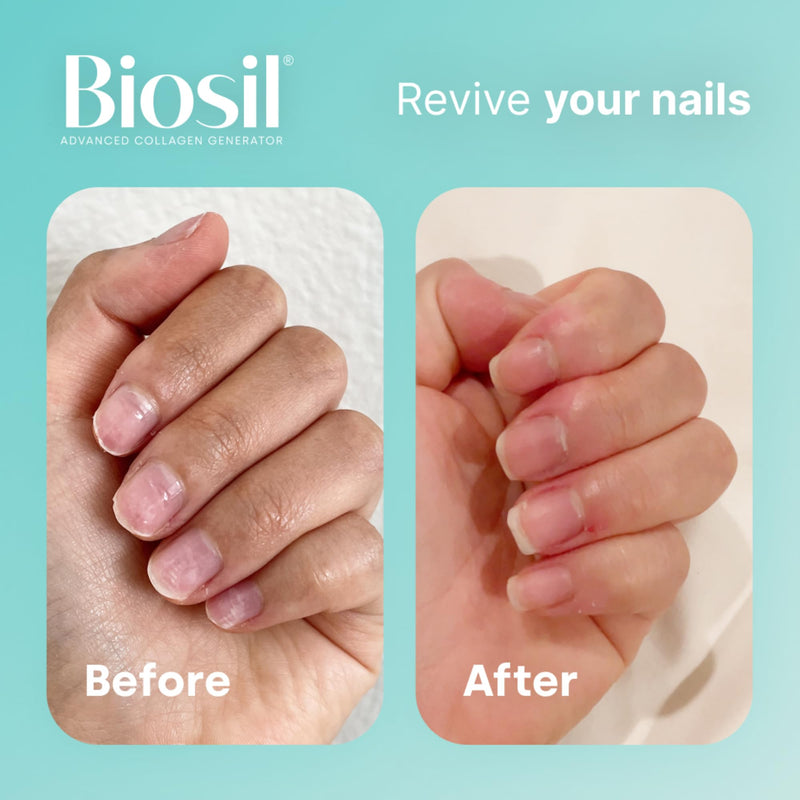 Biosil Collagen Generator - 30 Liquid Capsules - with Patented ch-OSA Complex - Generates & Protects Your Own Collagen - GMO Free - 15-Day Supply 30 count (Pack of 1)