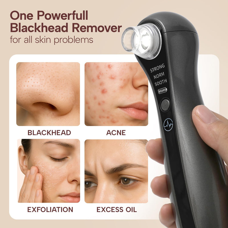 Blackhead Remover Vacuum with Camera Pore Vacuum, Black Head Extractions and Pore Cleaner, 3 Adjustment Modes & 3 Suction Heads