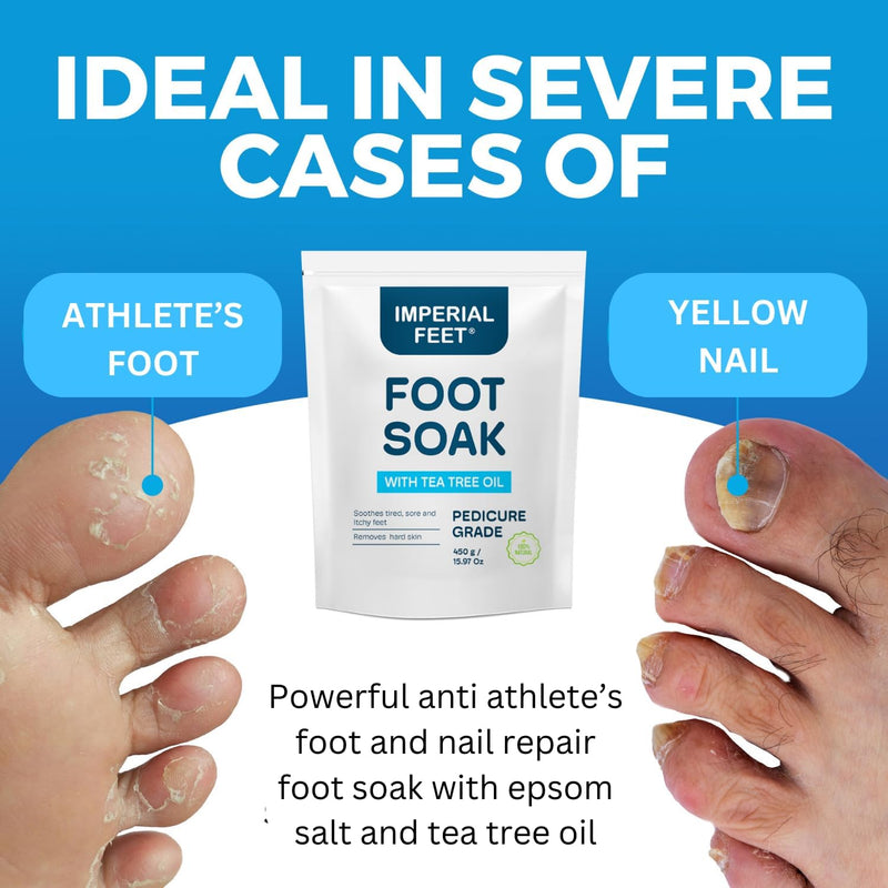 [Australia] - Epsom Salt Foot Soak w Tea Tree for Foot Bath (PEDICURE GRADE) - Toenail Repair, and Fungus Athletes Foot, Softens Calluses, Tired Feet, Nail Discoloration Foot Soak Salts, Smelly Foot Therapy16oz 