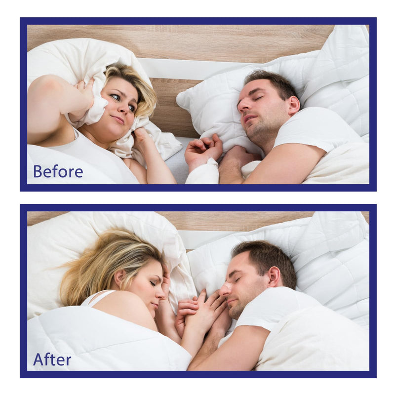 [Australia] - Nasal Strips,Clear Nasal Strips with Box(66mm*19mm) (30) 30 