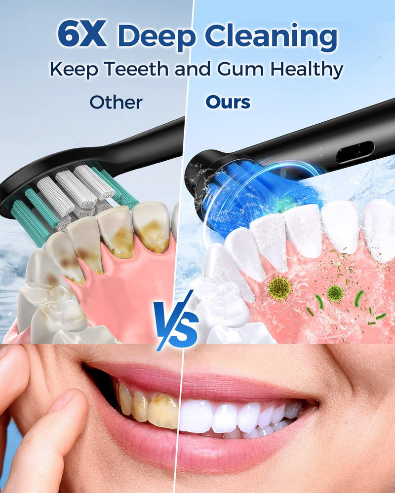 TEETHEORY Rotating Electric Toothbrush for Adults with 8 Brush Heads, Sensitive Gum Care Electric Toothbrush with 3 Modes and 2 Min Smart Timer, Rechargeable Last 60 Days Black 1 Count (Pack of 1)