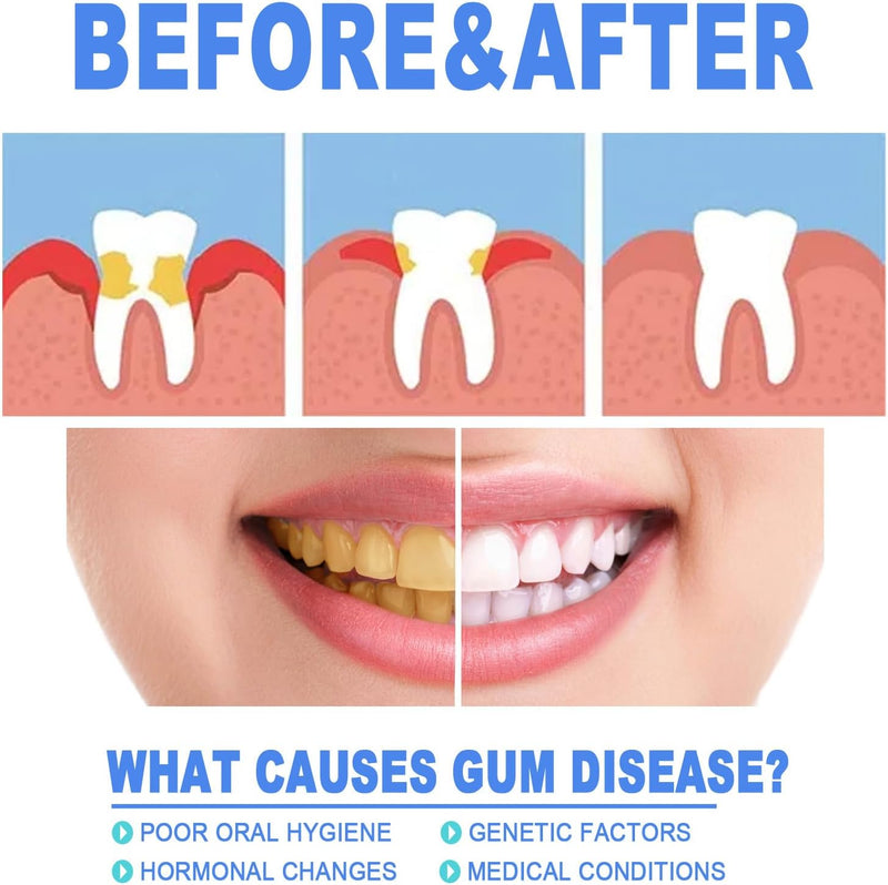 [Australia] - Gum Shield Therapy Gel,Gum Therapy Gel, Gum Repair Treatment Gel, Teeth Whitening Gum Shield, Gum Gel, Teeth Whitening Gel (3-pack) 