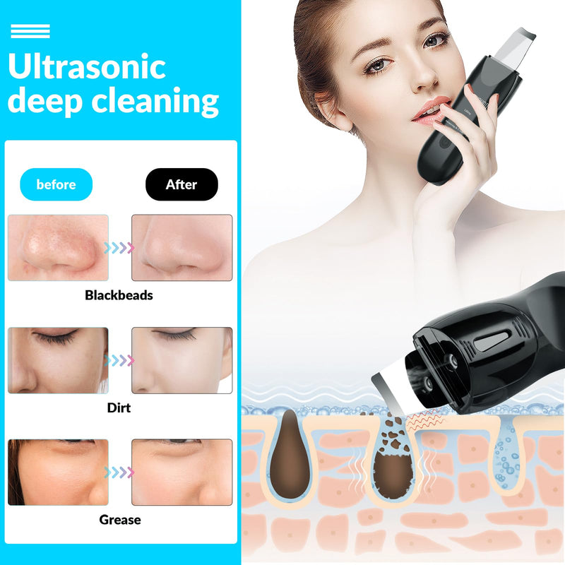 [Australia] - Facial Skin Cleanser with Mister, Upgraded Sprayer, Blackhead Extractor for Deep Cleansing and Moisturizing Spray 