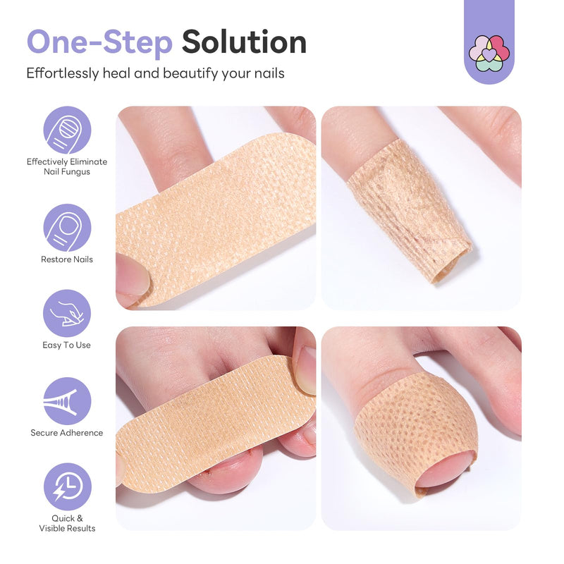 SAVILAND Fungal Nail Patches for Overnight 1% Tolnaftate Nail Repair 64Pcs | FSA-HSA, 8H Deep Overnight Repair, Reduces Yellow & Thick Nails, Breathable Materials Adhere Securely, Damaged Toenail Care 2 Pcs