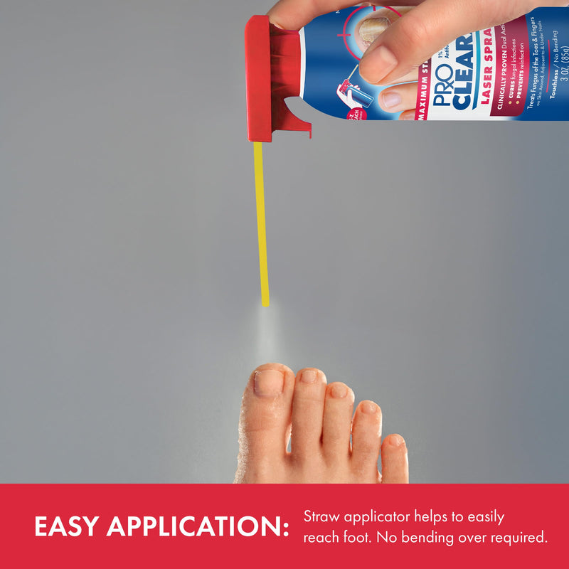 Laser Spray Antifungal Treatment, 3 oz, A Touch-Free Design To Help Prevent Fungal Infections | Hands-free spray nozzle delivers Tolnaftate 1% antifungal protection without touching affected areas