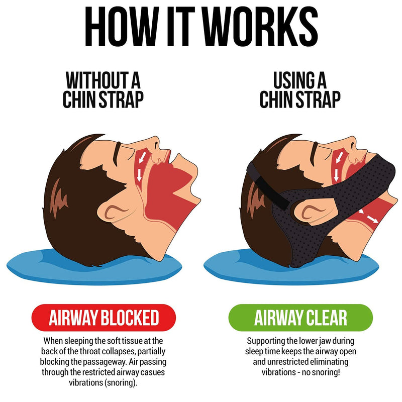 [Australia] - Anti Snoring Chin Strap for CPAP Users | Medium | Keep Mouth Closed While Sleeping | Adjustable Premium Snore Stopper Head Strap for Men and Women | Itch-Free Material for Uninterrupted Sleep M 