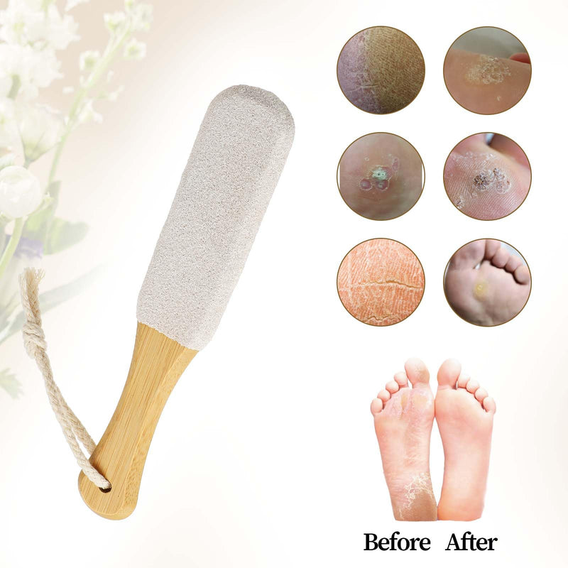 [Australia] - Pumice Stone Foot Care Callus Remover Foot Scrubber Removes Cracked Heels Light Stone Pedicure Foot Rasp Dead Skin Hard Skin File Brush for Feet Hands Body Wet and Dry Shower 