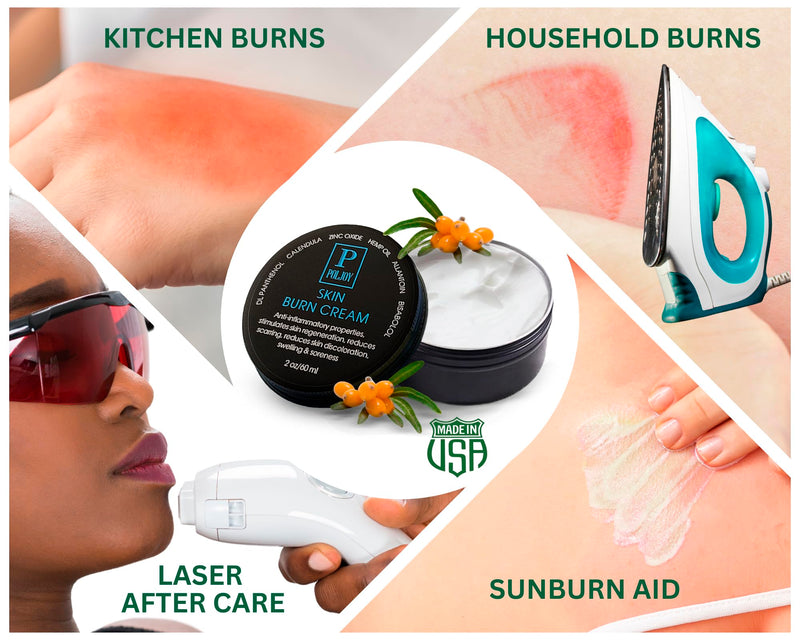 [Australia] - Skin Burn Cream Repair Natural - Post Burns Healing Remedy - Scar Care Promotes Recovery - Soothing First Degree Treatment - Sunburns Aid Fast Relief - Household & Vacation - Made in US (Pack of 1) 