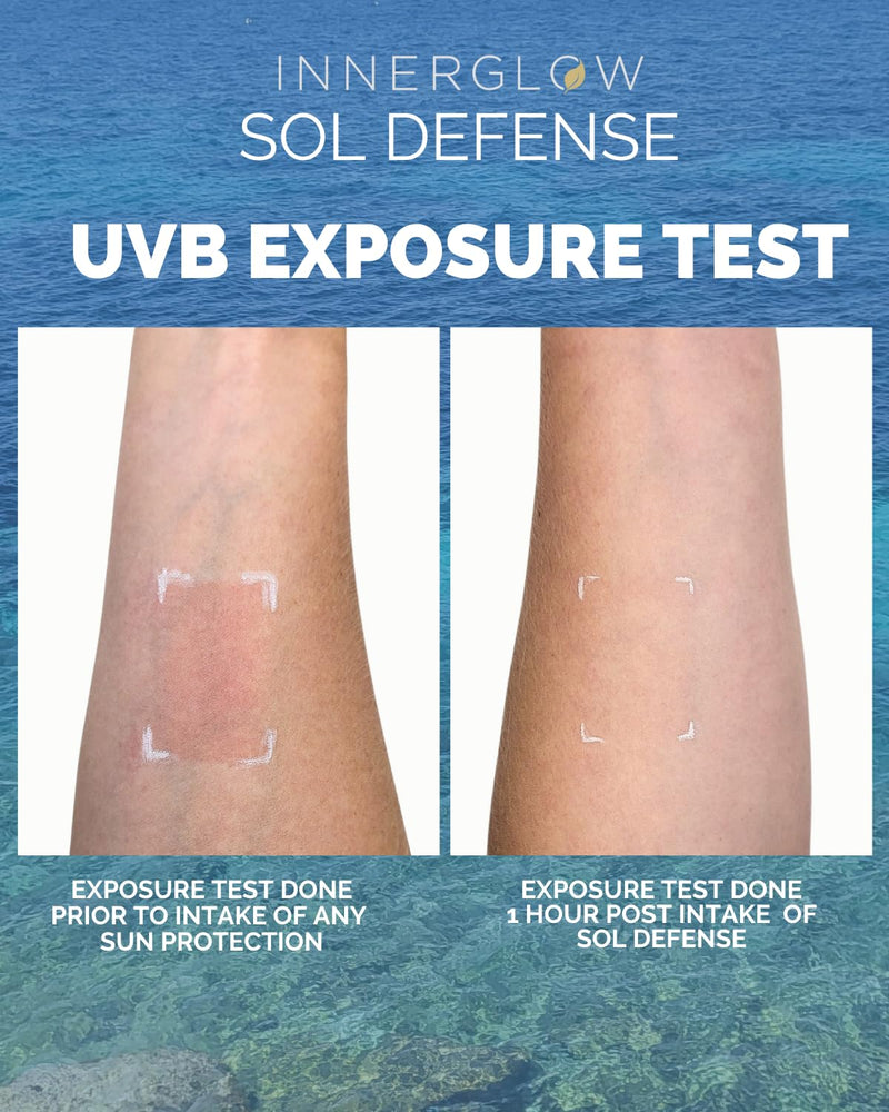 Inner Glow Sol Defense Gummies – Dermatologist & Plastic Surgeon-Formulated Skin Resilience Vitamin Supplement with Polypodium Leucotomos & Niacinamide, Passion Fruit Flavor, 60 Sugar-Free Gummies