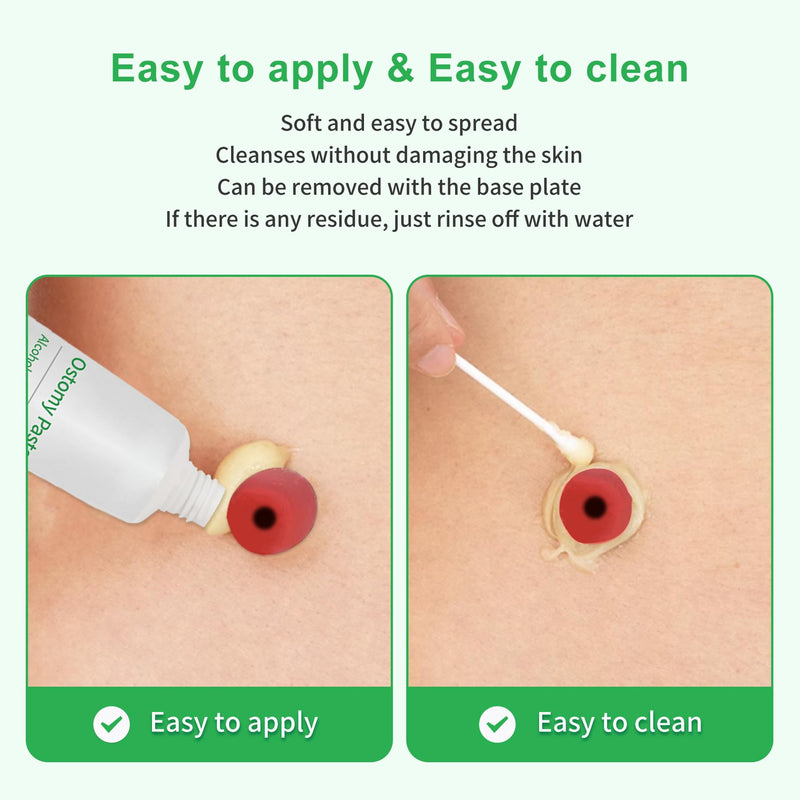 [Australia] - Stoma Skin Barrer Paste,Ostomy Paste 2 oz Tube (1 Pack) 2 Ounce 