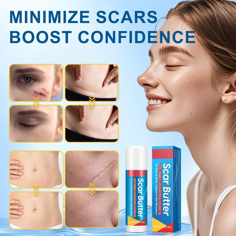 Scar Butter Stick for Scar, 100% Cocoa Butter with Vitamin E & Coconut Oil | Cocoa Butter Sticks Fade Scars, Stretch Marks, for Dry Face, Lip & Body, Non-Greasy, Portable Stick/swivel Applicator 1pc