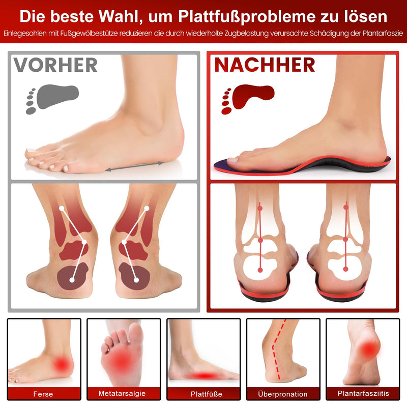 [Australia] - Orthopedic insoles for men and women, comfort work shoe insoles, orthopedic foot support for plantar fasciitis, flat feet, purple L purple L-EU44-46 (28-29.5cm) 