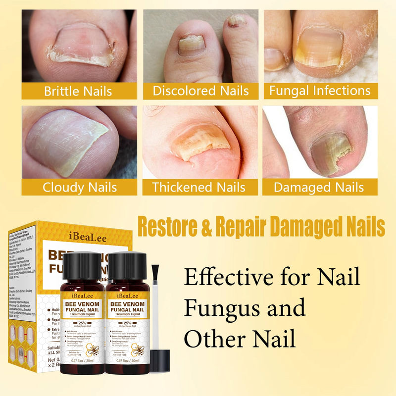 Toenail Treatment Extra Strength with 25% Undecylenic Acid for Yellow, Thick, Damaged, Discolored Nail -Y02