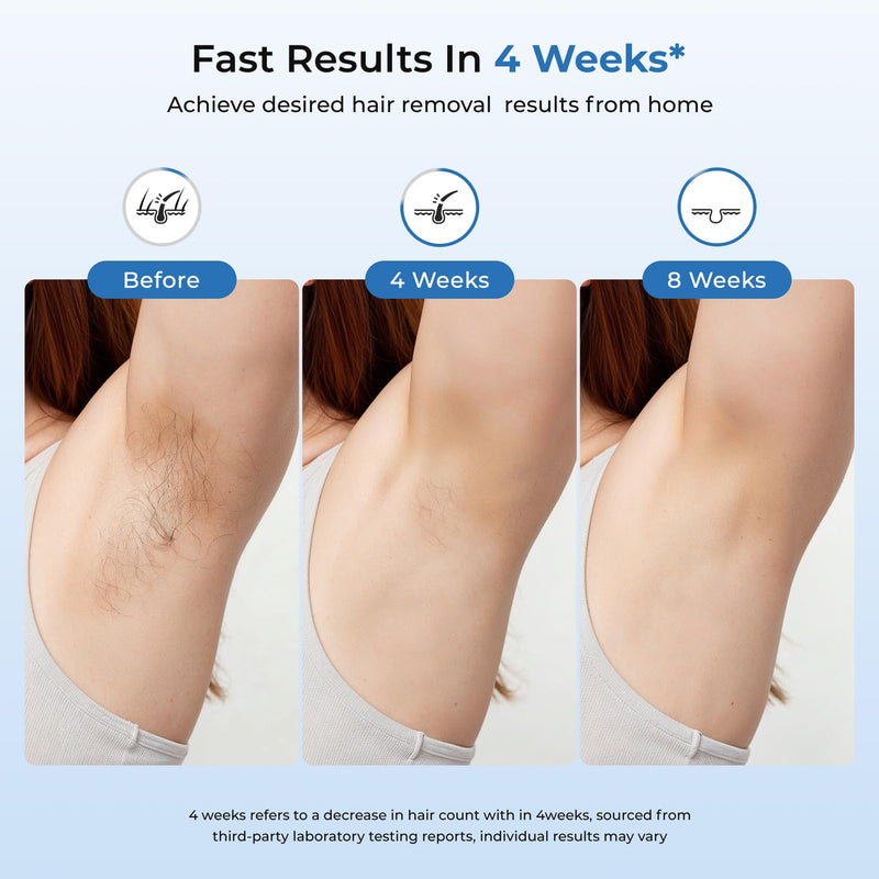 [Australia] - Aopvui IPL Laser Hair Removal, Laser Hair Removal for Women and Men with 5 C° Sapphire Ice-Cooling Function, Permanent at Home Laser Hair Removal, Painless Hair Removal Device with Unlimited Flashes 