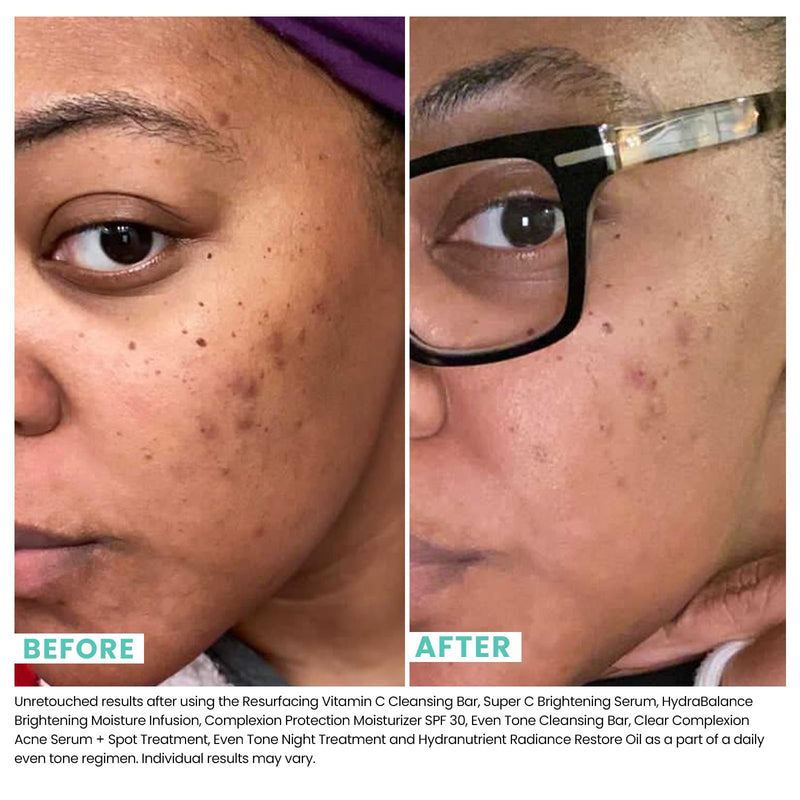 Urban Skin Rx Super C Brightening Serum | Vitamin C Face Serum with Kojic Acid & Ferulic Acid | Helps Improve Dark Spots, Uneven Skin Tone & Dullness | Antioxidant Facial Serum, 1 fl oz