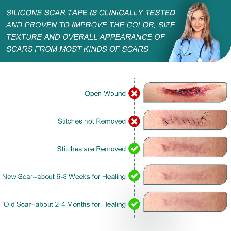 [Australia] - Silicone Scar Sheets (1.6"x 158" Roll-4M), Silicone Scar Tape for Scar Removal Treatment, Reusable Silicone Scar Strips for C-Section, Keloid, Burn, Acne, Surgical Scars 1.6"×158" 