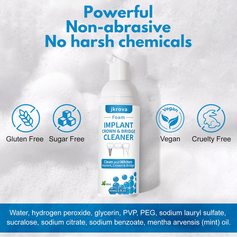 Dental Implant Cleaner, Cleans & Whitens Implants, Crowns, Bridges & Veneers, Freshens Breath & Supports Oral Health, Dental Bridge Cleaner Foam Bring Your Smile Back, 60ml