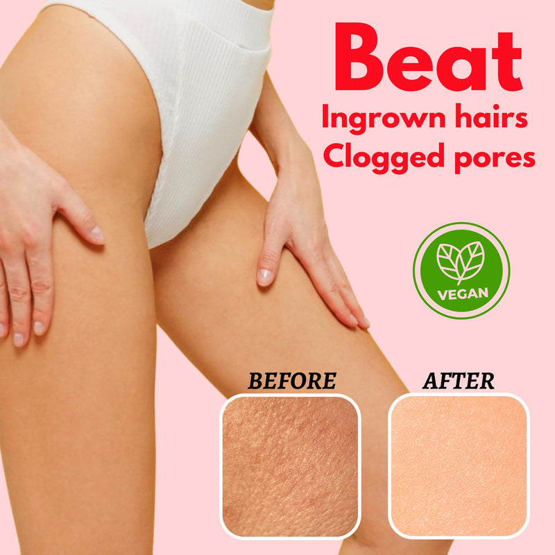 [Australia] - Bikini Area Exfoliator, 2% Kojic Acid Vitamin C & 7% AHA/BHA Even Skin Tone & Ingrown Hair for Rectum Intimate Butt Underarm Pack 1 