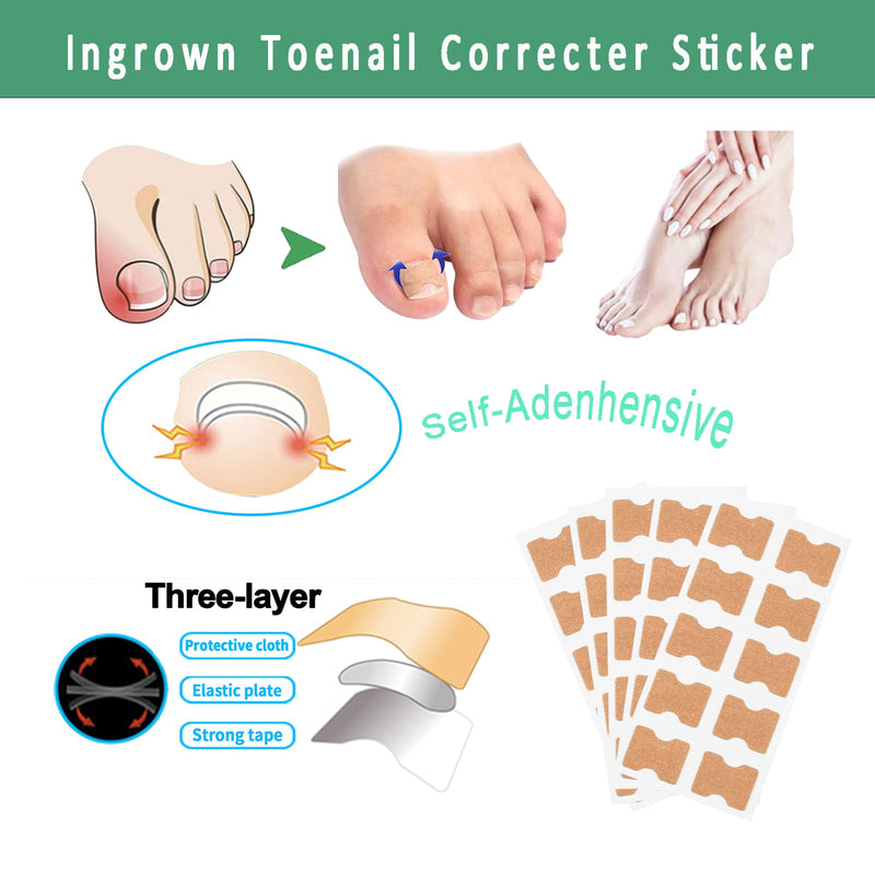 Professional Ingrown Toenail Treatment Set with Breathable Ingrown Toenail Strips,Ingrown Toenail Removal Kit,Curved Toenails Corrector Patch, Ingrown Toenail Corrector Tool Set for Home Use