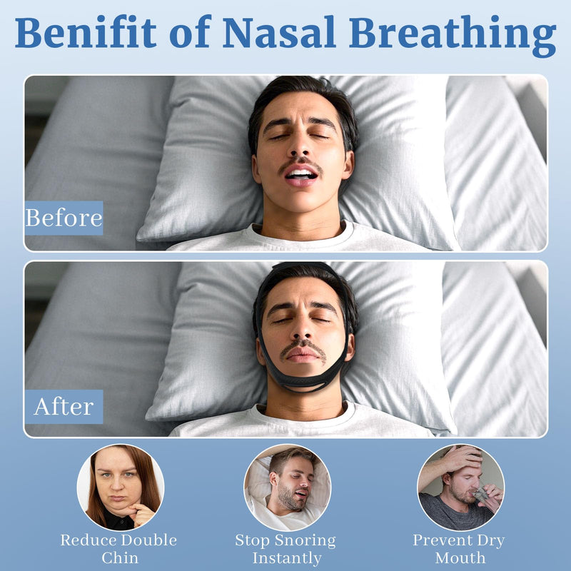 [Australia] - Snoring Chin Strap for Users, 2 Pack Adjustable Jaw Support Chin Strap to Keep Mouth Closed, Soft Snoring for Men Women, Lightweight Reusable, Snoring Dry Mouth, Comfort Fit Nighttime Sleeping Aid L Black+blue 