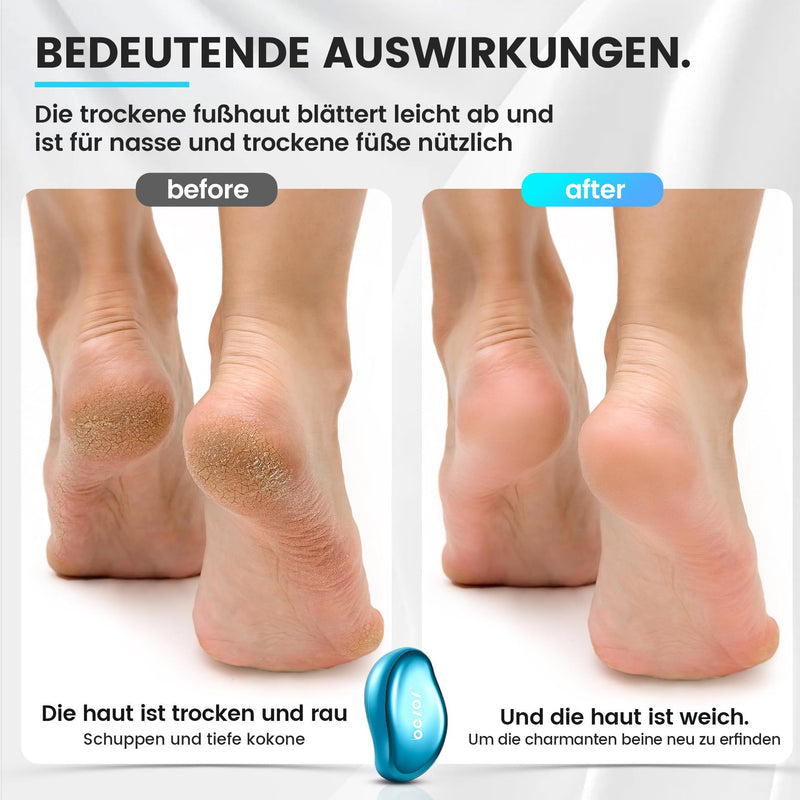 [Australia] - BEZOX 2in1 Nano Glass Callus Remover - Effective Nano Glass - Professional Pedicure - Premium Callus File Blue 