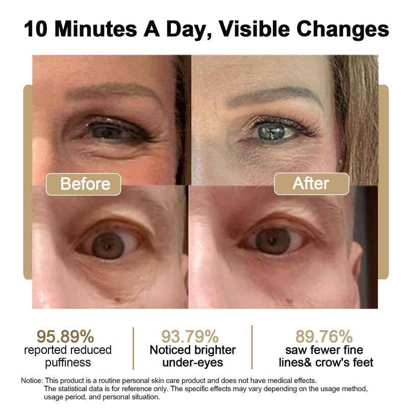 Under Eye Red Light Therapy Glasses Micro Vibration Eyelift Device Red Light Therapy for Relieve undereye Bags Fatigue Dark Circles Wrinkles Puffiness for Women and Men