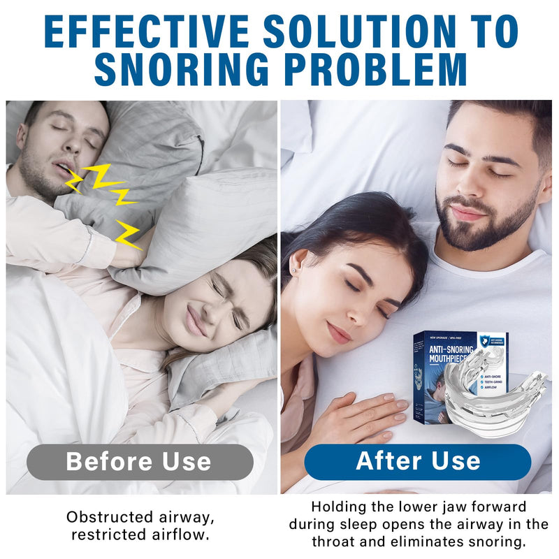 [Australia] - Snoring Stopper, Anti-Snoring Mouthpiece, Effective Snoring Stopper Bite Splints, Adjustable Grinding Splint for Night for Men and Women, Anti Snoring Splint Prevent Bruxism & Snore 1 Count (Snoring Stopper) 