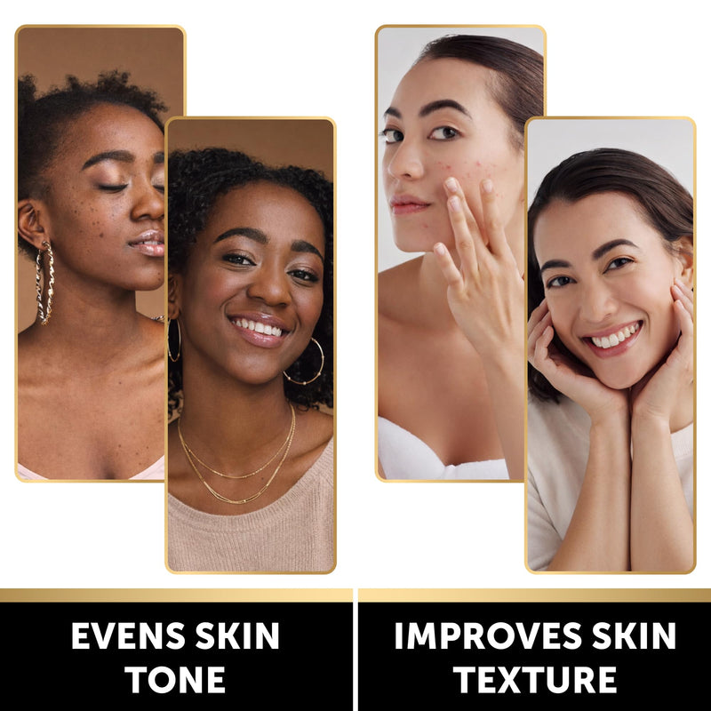VALITIC Brightening Lemon & Turmeric Kojic Acid Soap with Vitamin C, Retinol, Collagen - Original Japanese Complex Infused with Hyaluronic Acid, Vitamin E, Shea Butter - Dark Spot Corrector (5 Pack) 5 Pack
