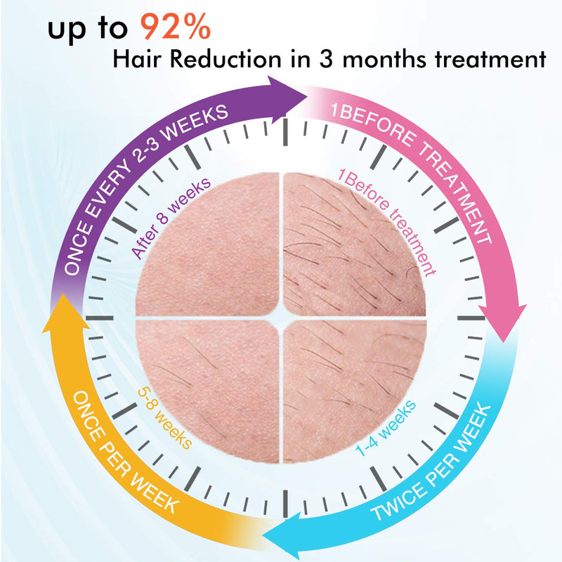 [Australia] - IMENE Permanent Hair Removal Machine for Women & Men, 500,000 Flashes IPL System with Ice Care Function for Full Body Home Use - Safest and Fastest IPL Technology 