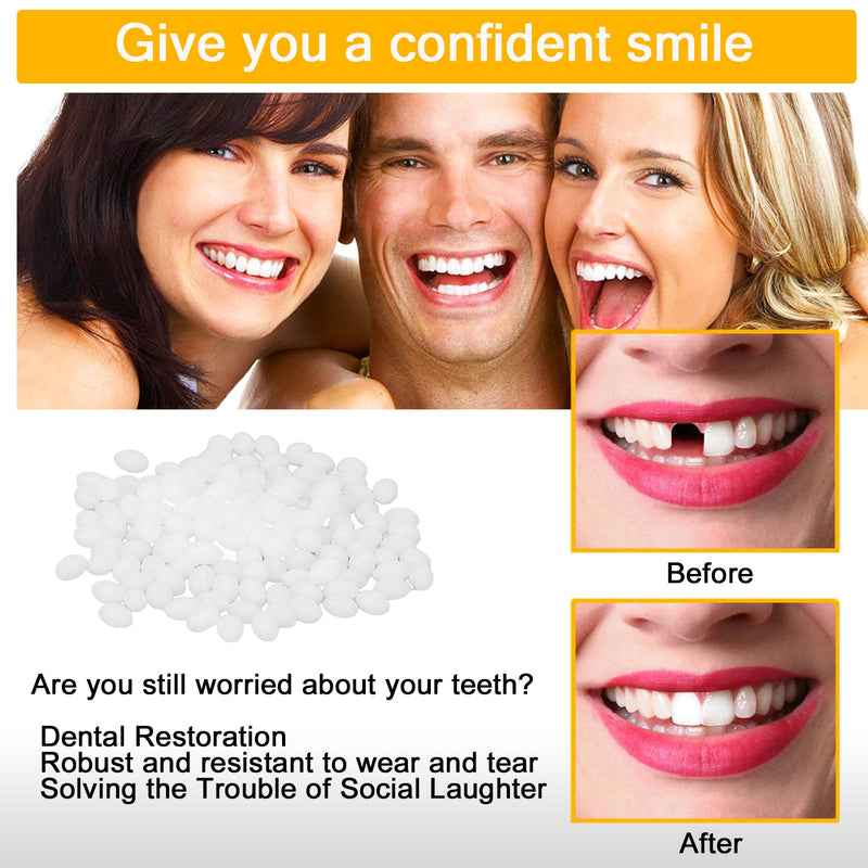 [Australia] - lankai Temporary Tooth Repair, Dentures, Temporary Teeth, Dentures DIY, Temporary Tooth Repair Set, Thermal Adhesive Beads for Missing Broken Tooth Fake Tooth Veneer (100g) 