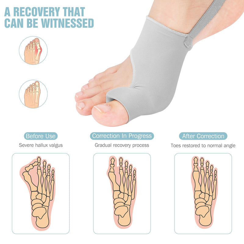 [Australia] - 2PCS Bunion Corrector for Women & Men Big Toe, Big Toe Separators-Bunion Splint-Bunion Pads-Hammer Toes Straightener-Toes Spacers Pain Relief, Comfortable & Breathable for Day/Night Gray 1 