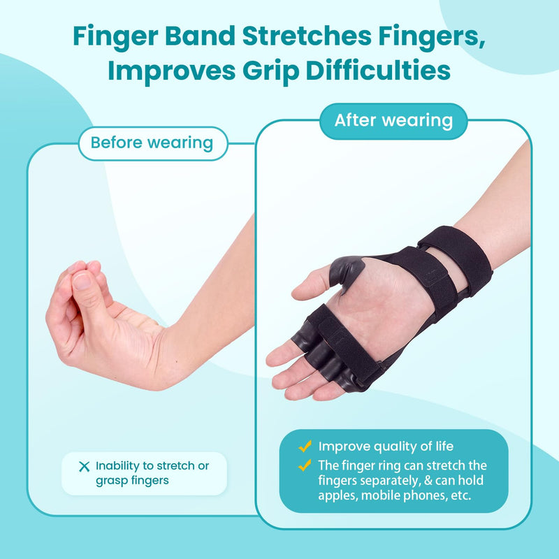 [Australia] - Radial Nerve Palsy Splint Brace for Wrist drop, 5 Fingers Extension, Stroke Patient Recovery, Finger Limp, Crutch Palsy, MCP Arthroplasty, for both Left and Right Hand - Black 