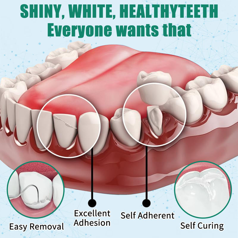 [Australia] - Temporary Replacement Tooth Repair Kit, Zinc Oxide Eugenol Cement Dental Care Kit Glue for Crowns & Bridges Filling, Perfect Smile (6) 